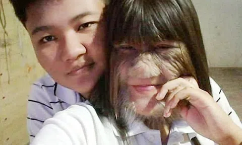 Chuyện tình như mơ của cô gái \'lông lá nhất thế giới\'